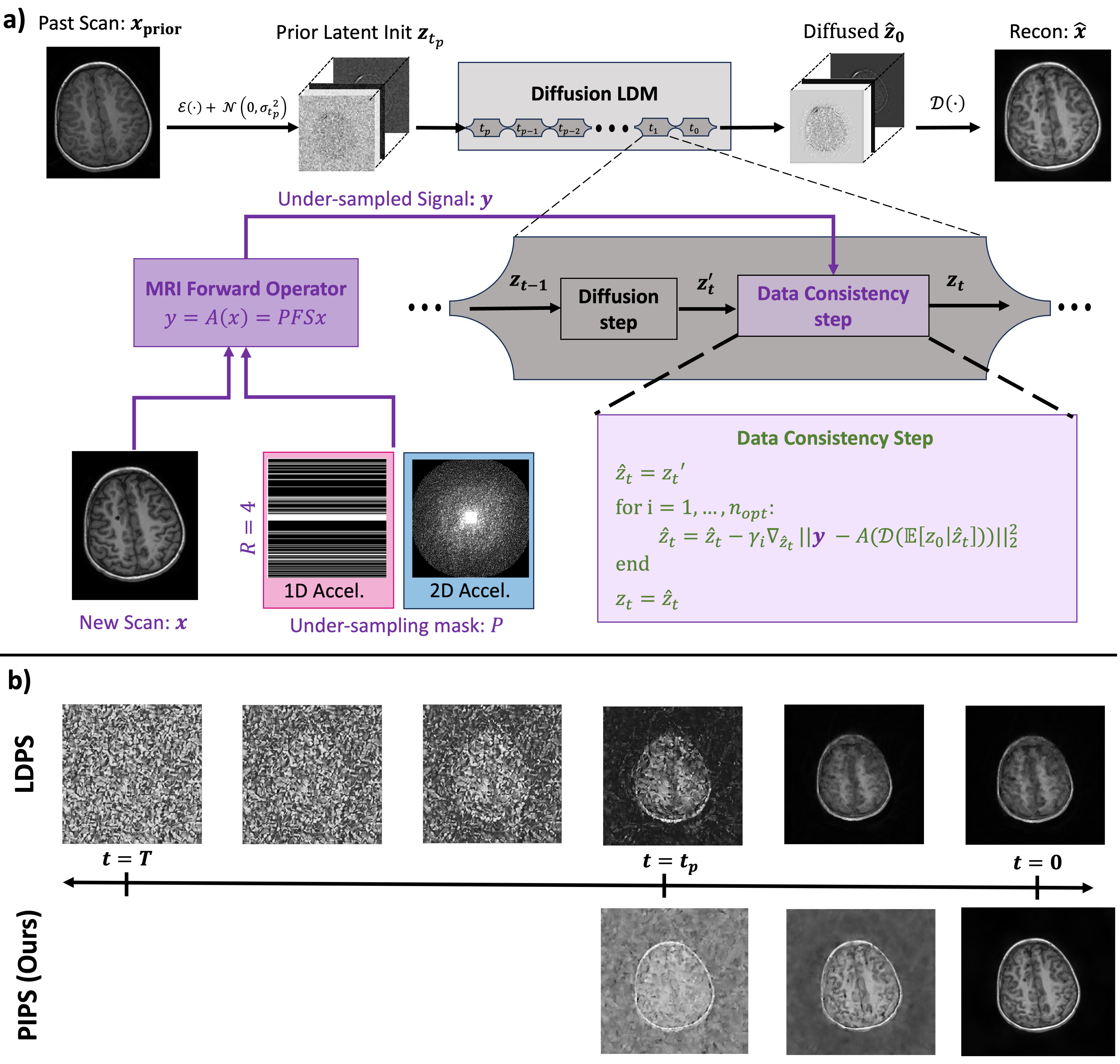 pips_methods_figure